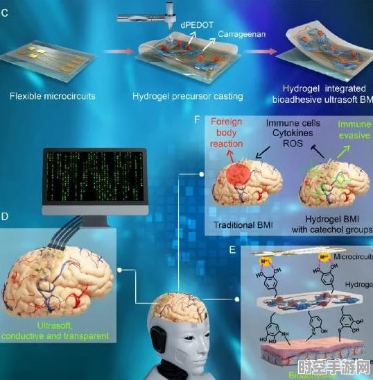 上海团队柔性脑机接口临床试验获重大突破